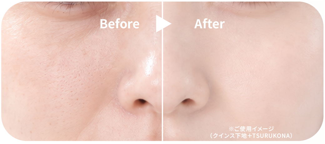 Before After